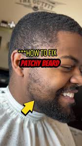 How to Fix a Patchy Beard: A Complete Guide to Filling in the Gaps